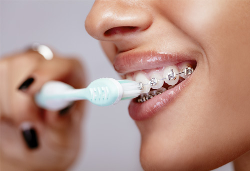 cuidar las encías y los dientes con ortodoncia