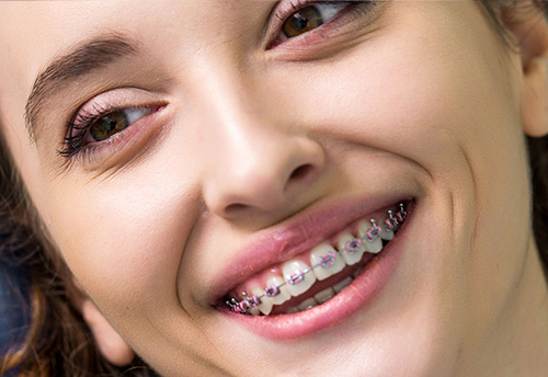 la ortodoncia mejora su calidad de vida